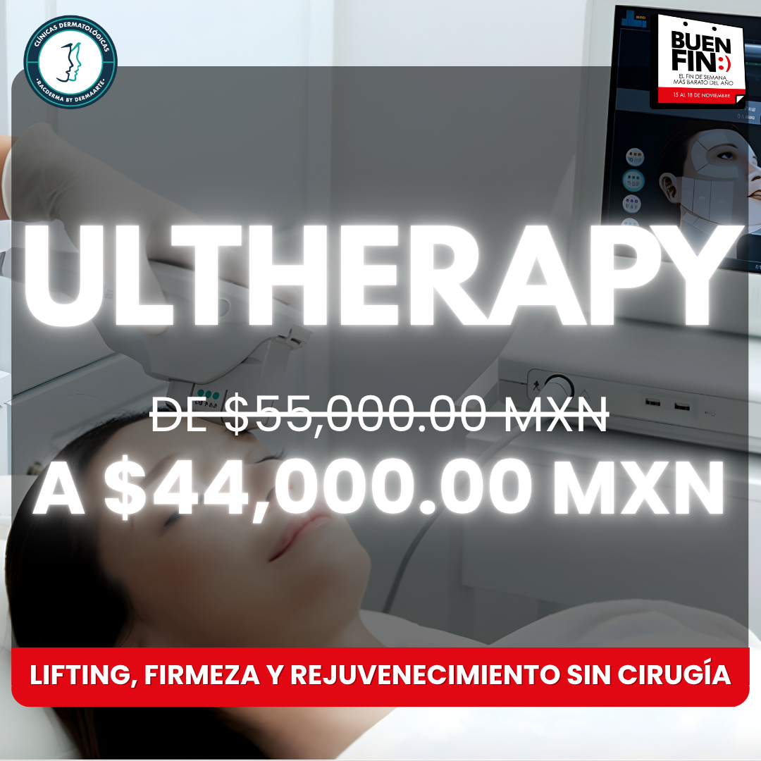 💥 ¡El LIFTING SIN CIRUGÍA LLEGA AL BUEN FIN! 💥