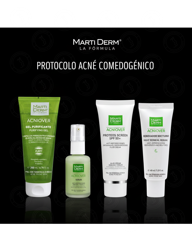 🧬 Protocolo: Acné Comedogénico | MartiDerm